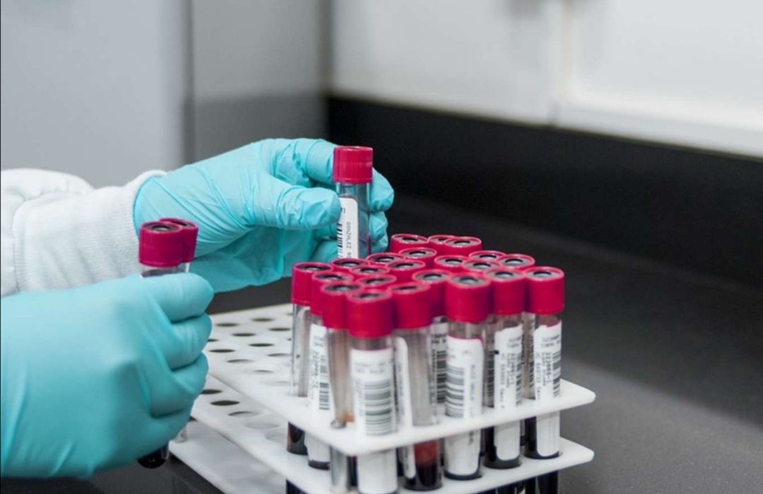 Türkiye'de ilk kez toplam Coronavirus vaka sayısı açıklandı