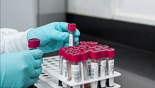 Türkiye'de ilk kez toplam Coronavirus vaka sayısı açıklandı