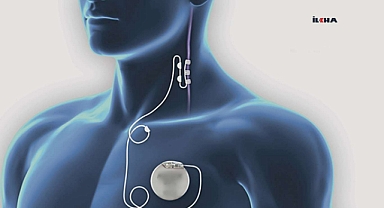 Epilepsi hastalığı ve epilepsi pili hakkında bilinmesi gerekenler 