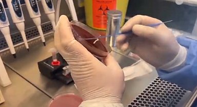 Hatay'da barsak enfeksiyonuna karşı testler yapılıyor