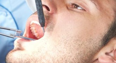 Aşırı bruksizm diş kaybına neden olabilir