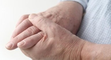 'Romatoid Artrit' nedir ve tedavi yolları nelerdir?