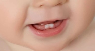 Diş sağlığı için erken yaşta önlem alınmalı