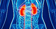 Böbrek kanserine neden olan 8 risk faktörü